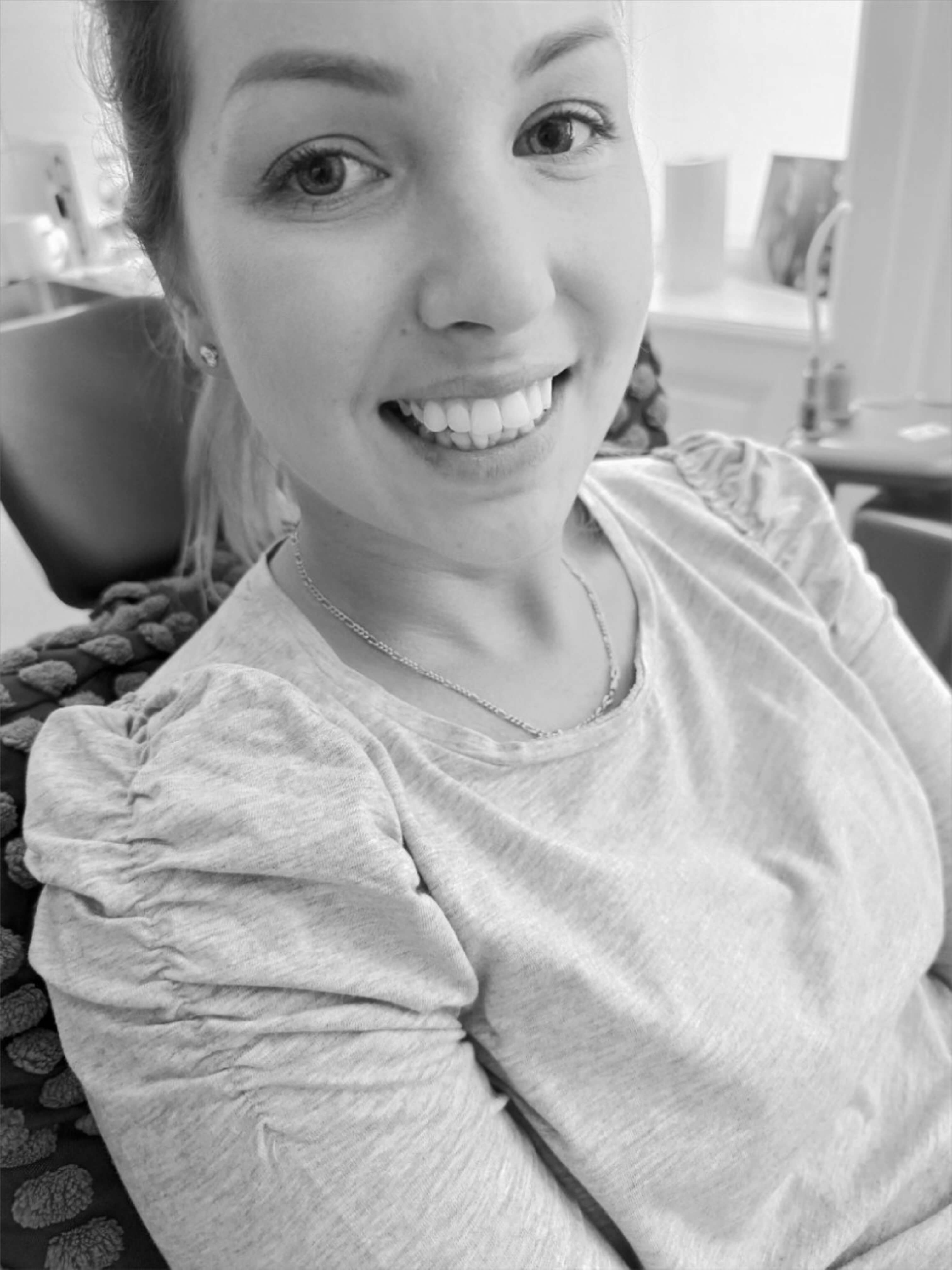 Professzionális rendelői fogfehérítés kezelés